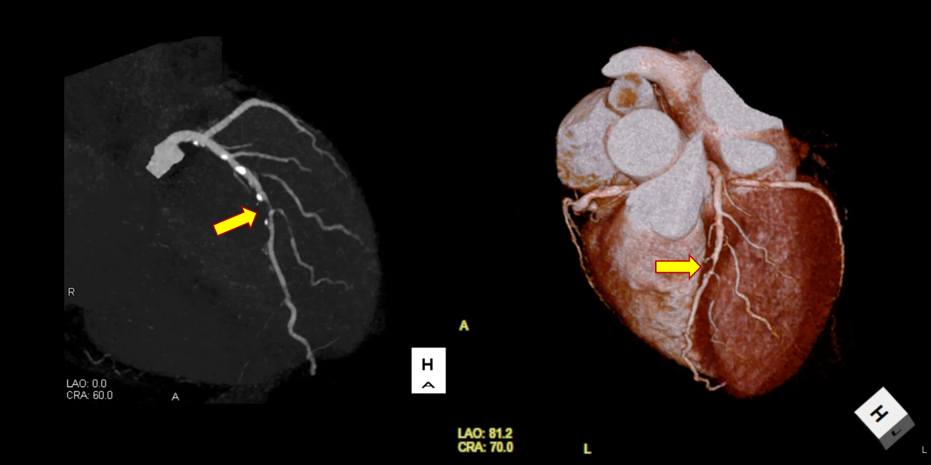 胸の痛み・息苦しさの原因は？